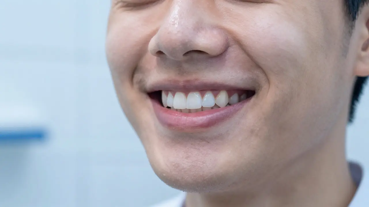 Jak se lečí Zákus? Kompletní průvodce zubními fazetami a náklady